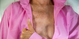 woman with a mastectomy