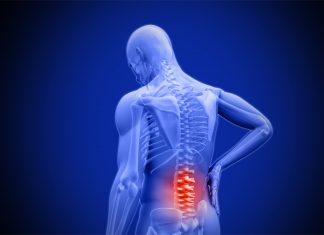 What is the Cause of my Back Pain?