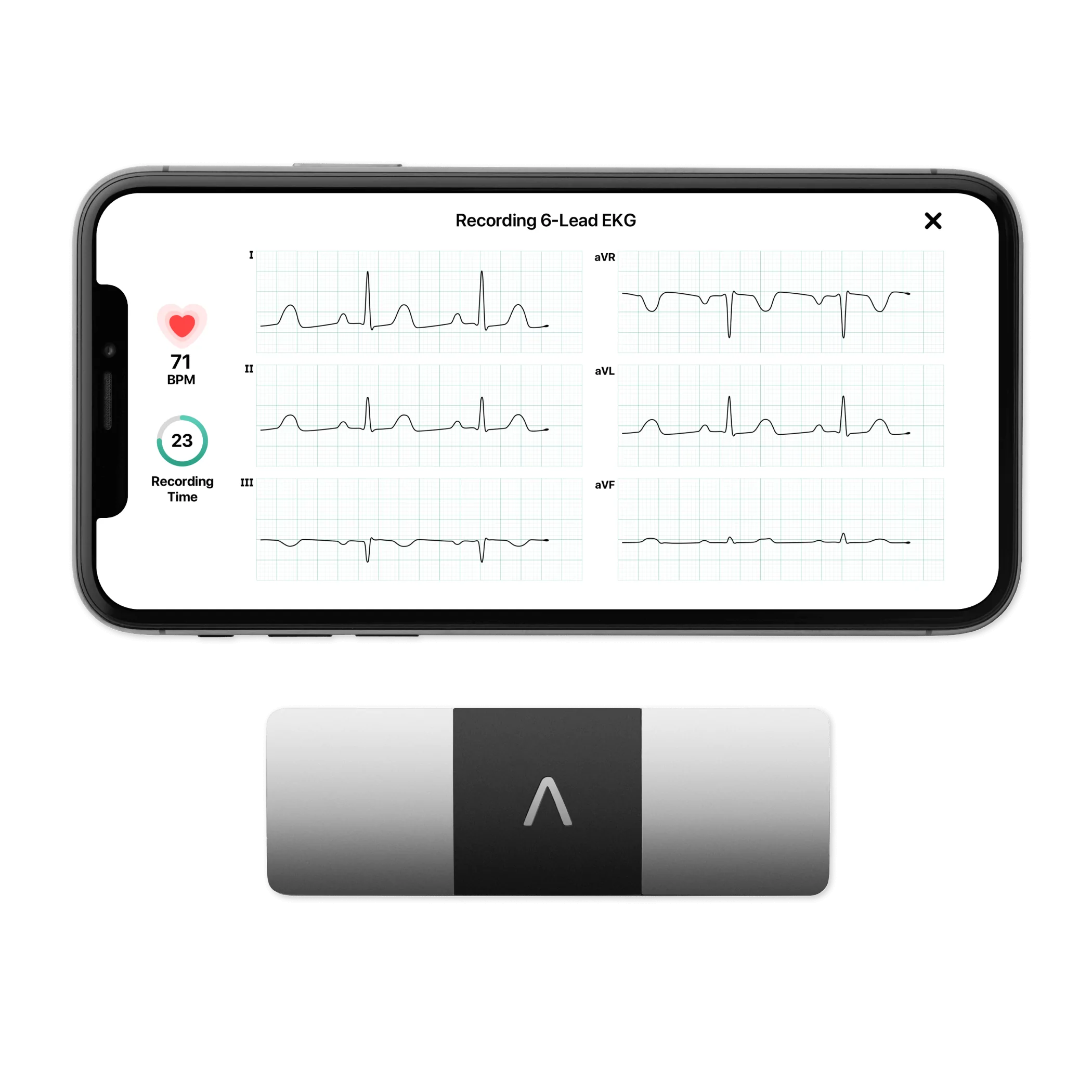 Alivecor kardiamobile 1