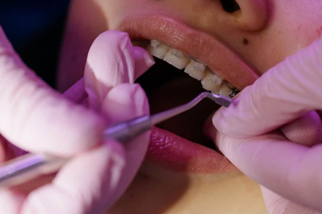 Gain Peace Of Mind With Careington Dental: Affordable And Quality Care For Your Teeth