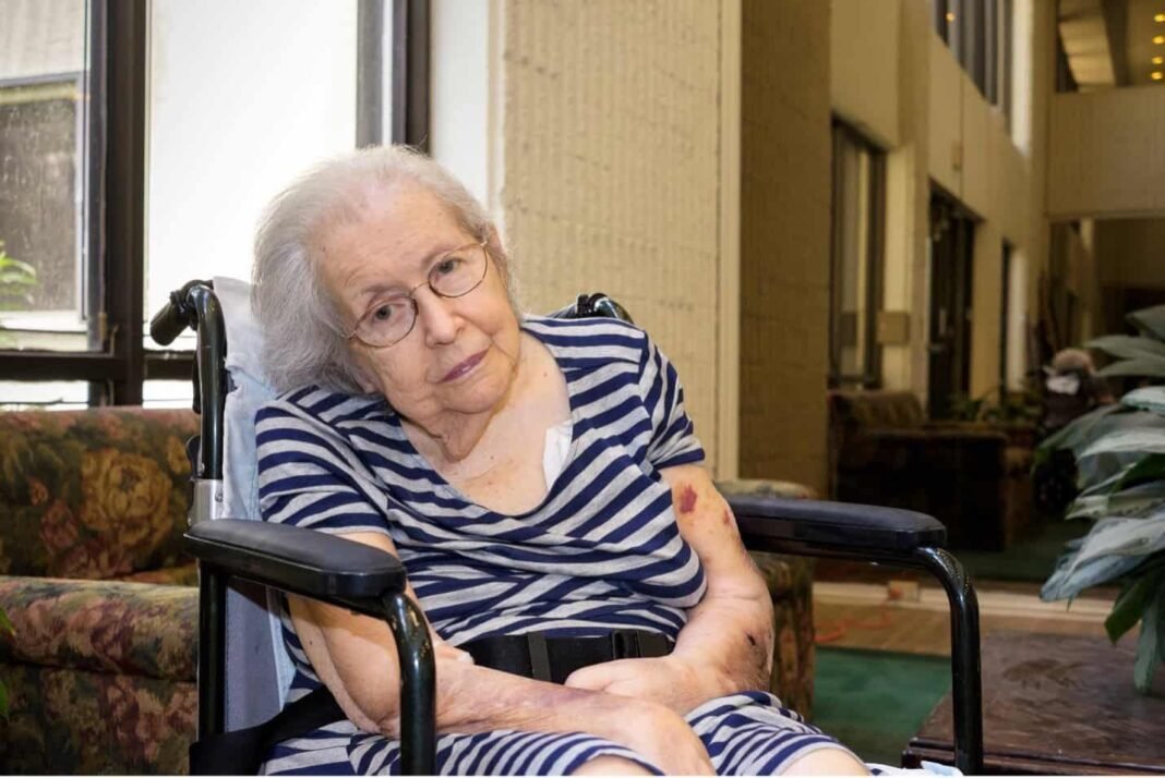 Post-Stroke Conditions In The Geriatric Population