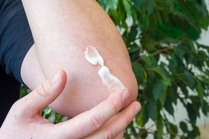 Tendonitis Pain and CBD Cream