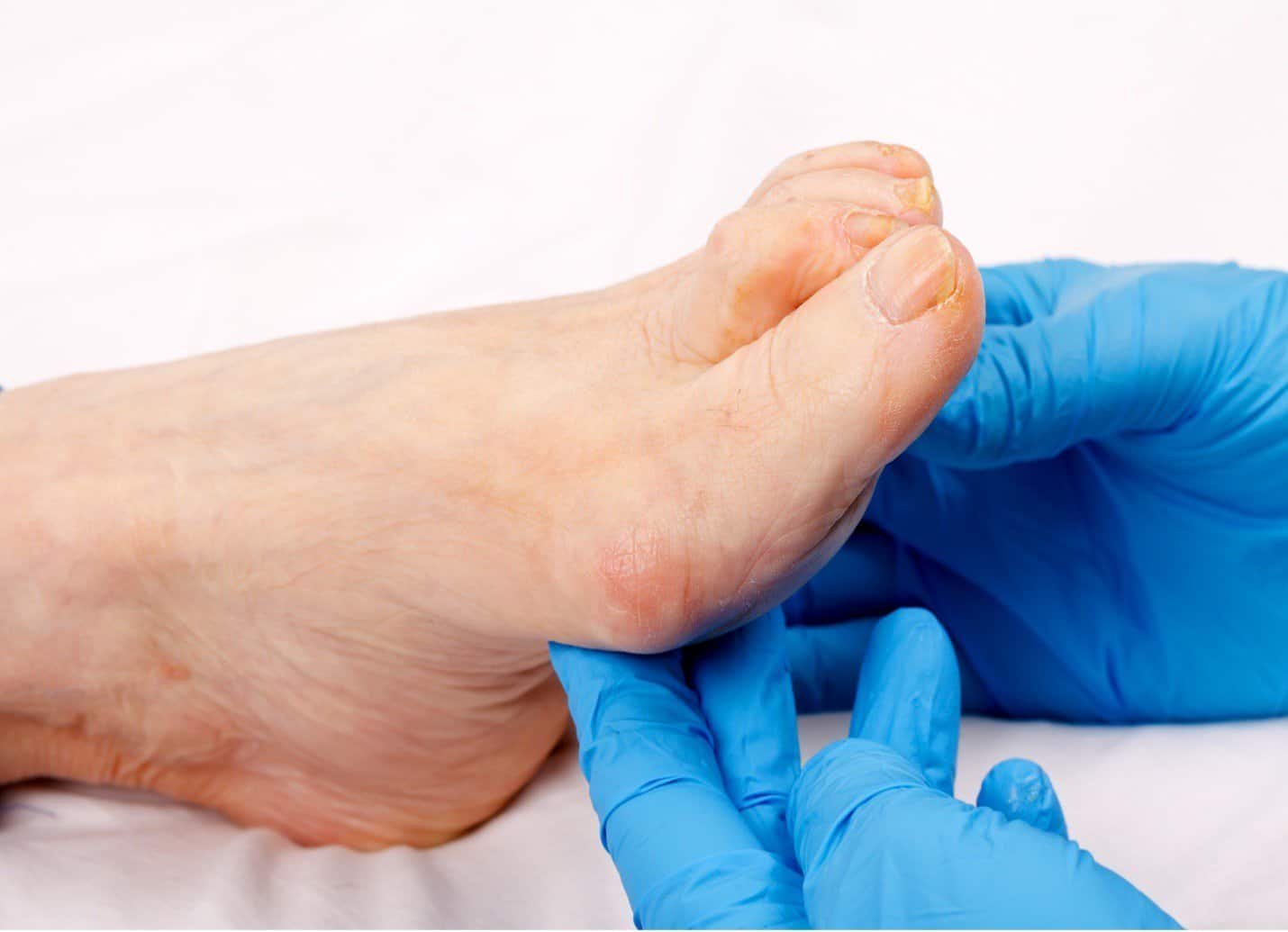 Title Types Common Of Wounds in the Elderly 1