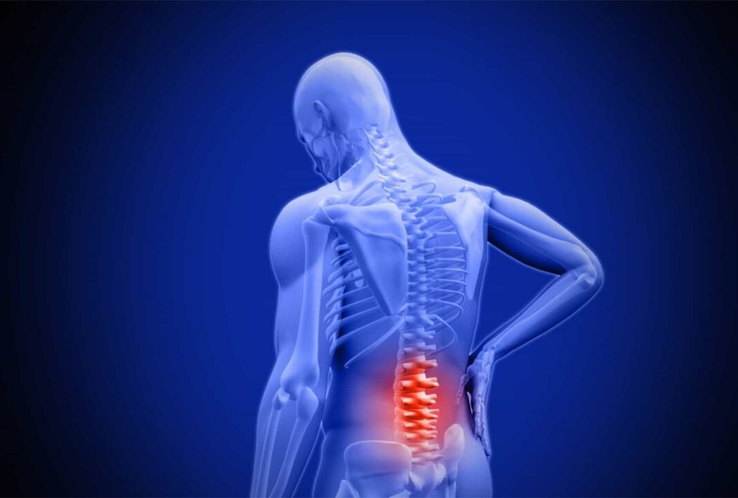 What is the Cause of my Back Pain?