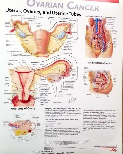 Learn all about the Big Four Cancers and more from The Authorities 3 healthcare and medicine ovarian cancer medical visual aid t20 N0j2gl